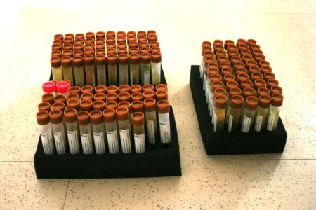 Vzorci za DNA analizo.